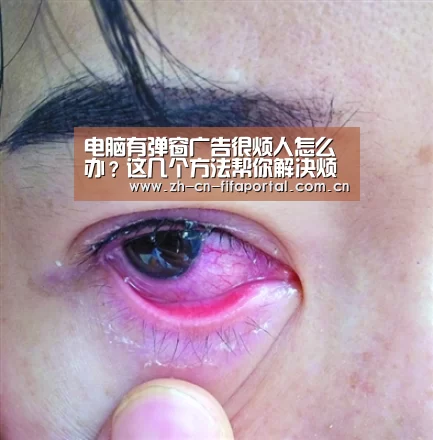 电脑有弹窗广告很烦人怎么办?这几个方法帮你解决烦恼:世界杯赛程(图2) 球队资讯